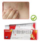 999 Pi Yan Ping Itch Relief Ointment 20ml