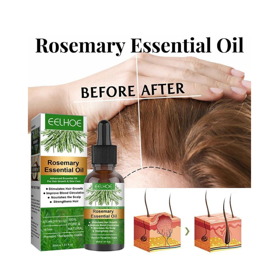Eelhoe Rosemary Essential Oil for Hair Growth before after