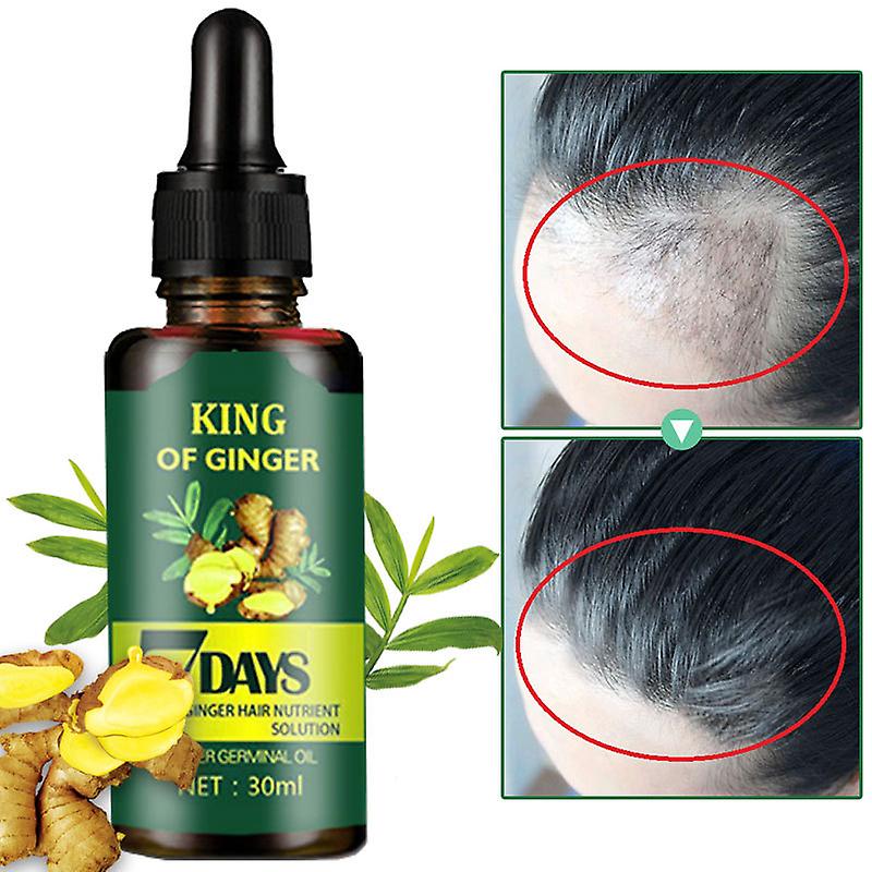 New Organic King of Ginger Hair Oil for Men