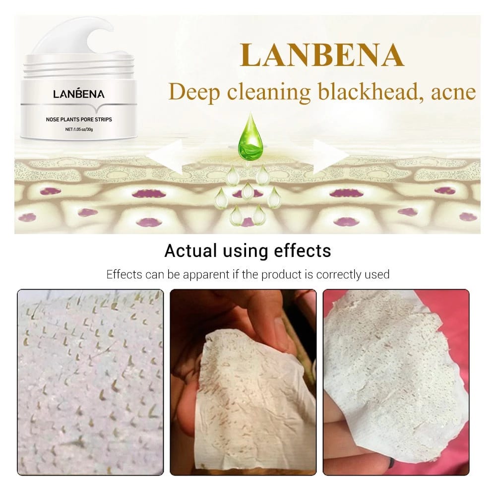Lanbena Deep Cleaning Blackhead Acne