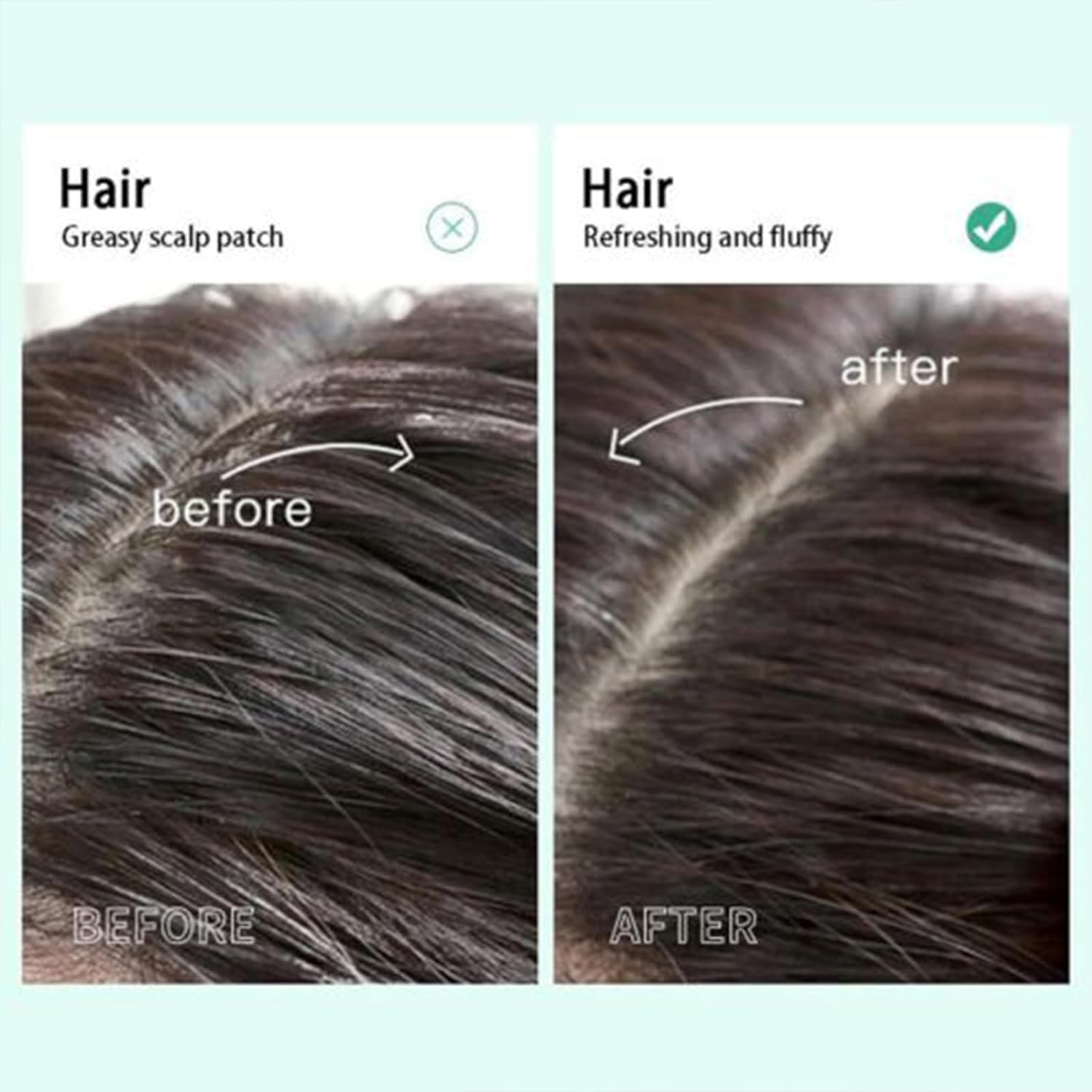 Maigoole Dandruff Removing Scalp Element